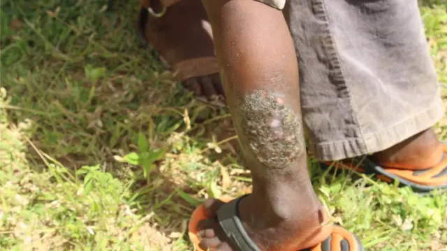 ህጻናት ባህሪያቱ ብዘይፍለጥ ሕማምን ሕማማት ቆርበትን ይጥቅዑ ነይሮም