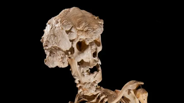 جمجمة ميريك