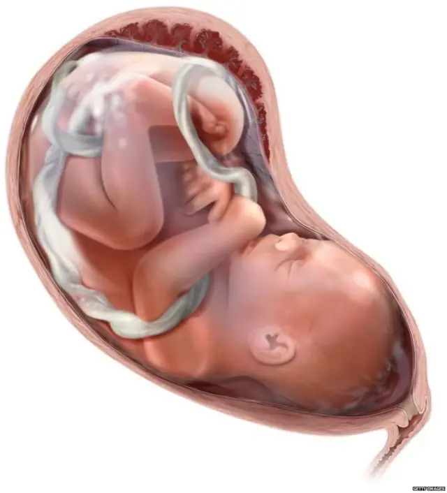 బొడ్డుతాడు కత్తిరించడానికి ఒక సమయం ఉండాలా