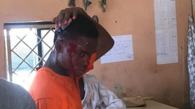 Blood dey comot Ahmed Sani head