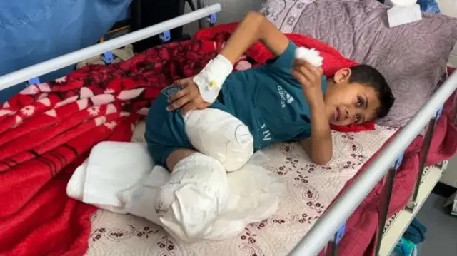 Yassin al Ghalban, 11 ans, a perdu ses jambes lors d'un bombardement israélien.