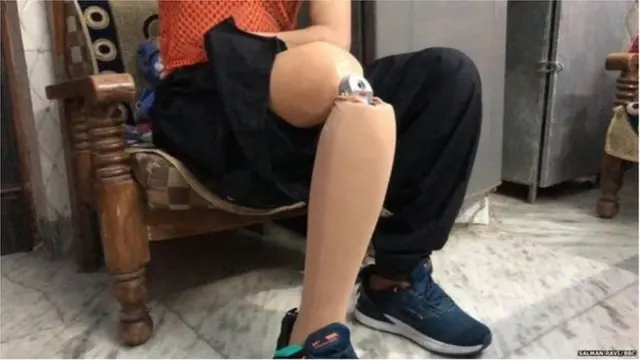 కృత్రిమ కాలు