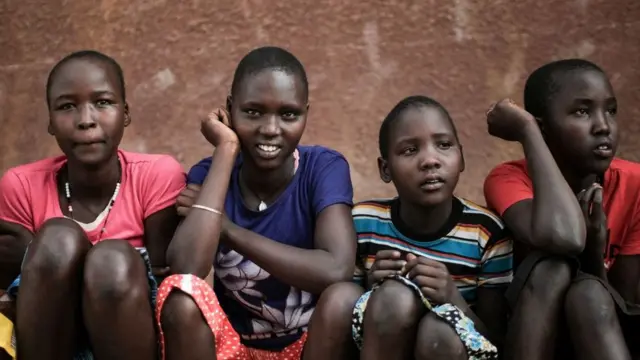 FGM