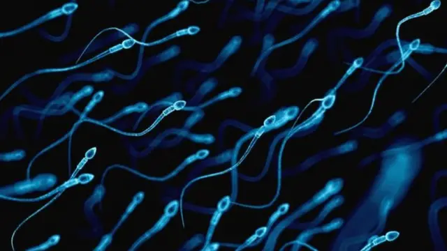 Sperm