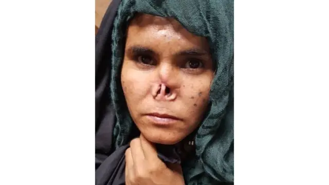 Zarka with her mutilated nose