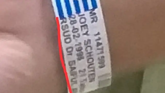 Gelang perawatan rumah sakit.