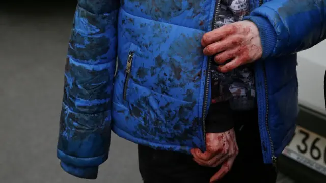 آثار الدماء على أحد المصابين