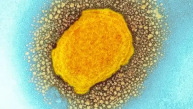 মাংকিপক্স ভাইরাস।