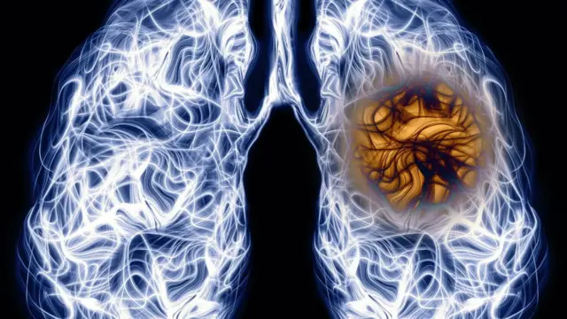 கொரோனா வைரஸைவிட இந்தியாவில் இந்த நோயால்தான் அதிக உயிரிழப்பு - என்ன காரணம்?