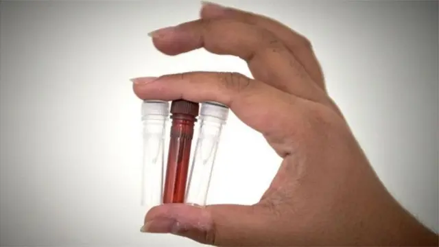 কোভিড-১৯র টিকা বানানোর জন্য প্রায় শতাধিক প্রকল্প চলছে বিভিন্ন দেশে