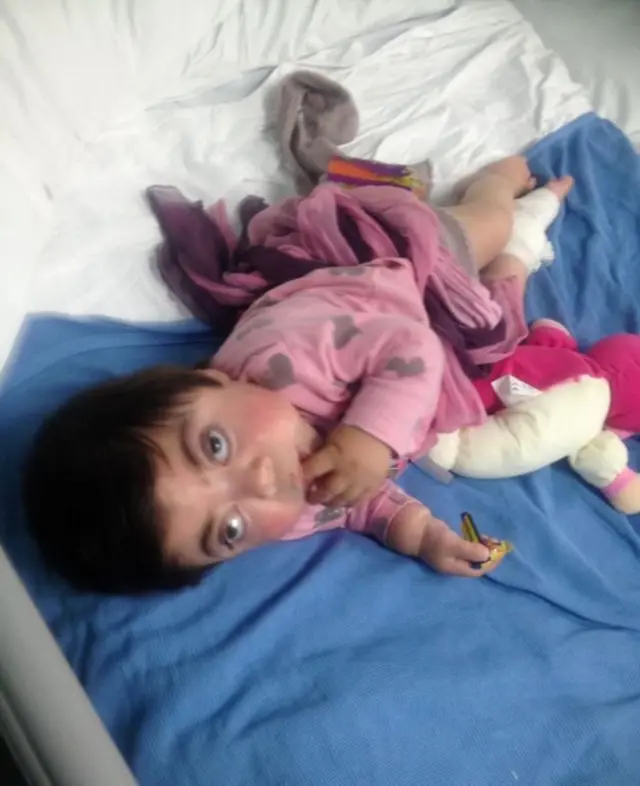 طفلة نتيجة زواج الأقارب في بريطانيا