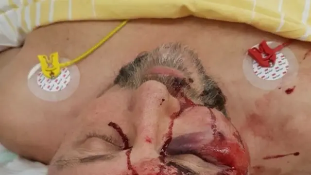 Йорг Мойтен/Twitter