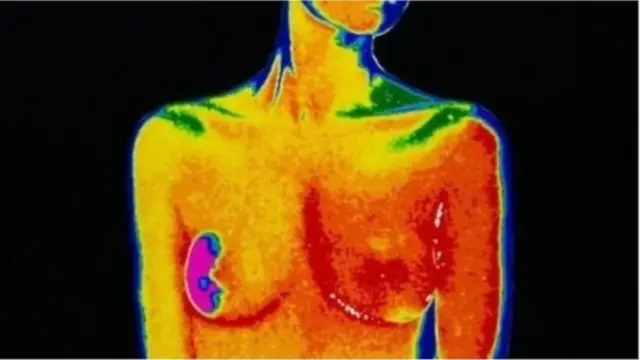 গবেষকরা বলছেন, হরমোন থেরাপির সাথে নতুন ধরনের ঔষধের সংমিশ্রণে প্রাথমিক পর্যায়ে স্তন ক্যান্সারে আক্রান্ত কোনো কোনো মহিলার ক্ষেত্রে আরো বেশিদিন বেঁচে থাকা সম্ভব