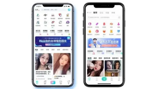 சீனா அழகு பிளாஸ்டிக் சர்ஜரி