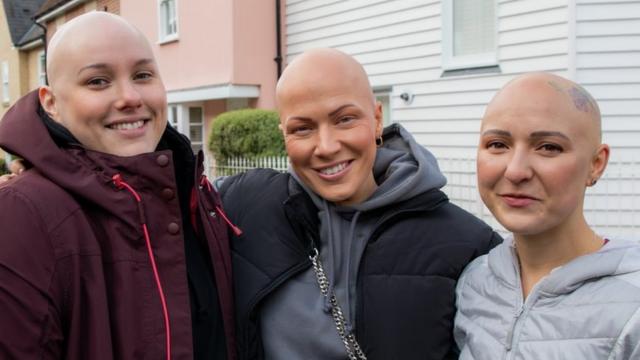 Alopecia patient calls for bald emoji to help represent hair loss - BBC News