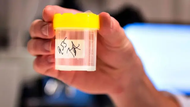 Una muestra de semen en un banco de esperma