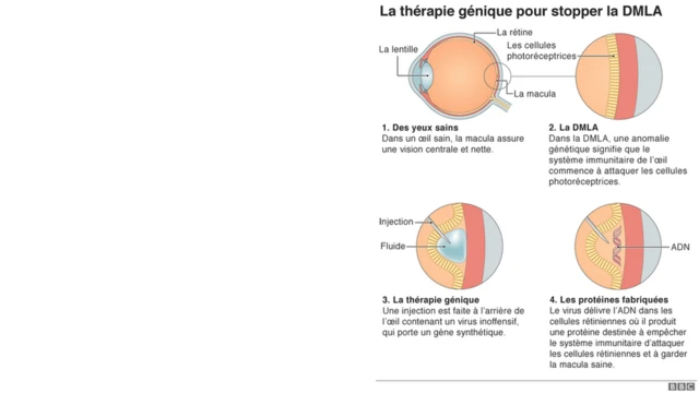 L'anatomie de l'oeil