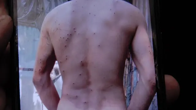 कश्मीर: 'उस पैलेट गन ने मेरे ज़िंदगी बर्बाद कर दी'