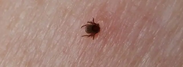 Shillinta nooc ka mid ah ayaa laga qaadaa xanuun daran oo wadnaha haleela