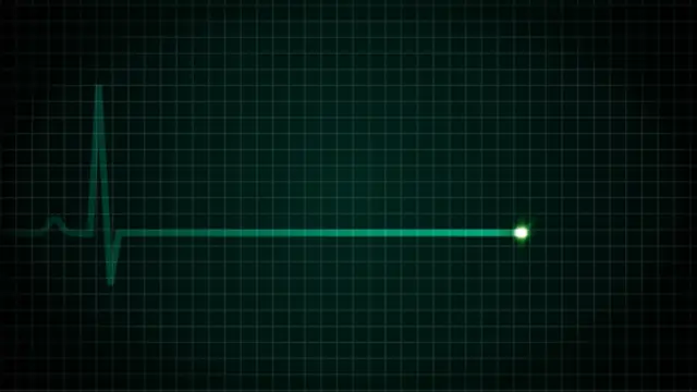 Dibujo de un electrocardiograma plano.