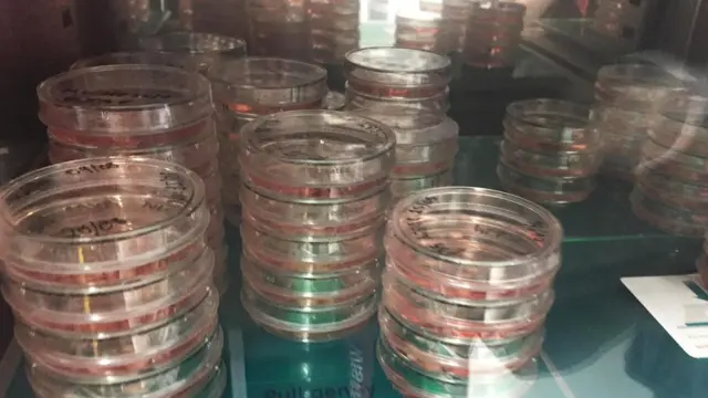 Цель Ланкастер - превратить кожу человека в функционирующие клетки мозга