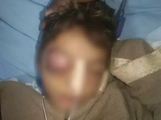 தலித் சிறுவன் உயிரிழப்பு