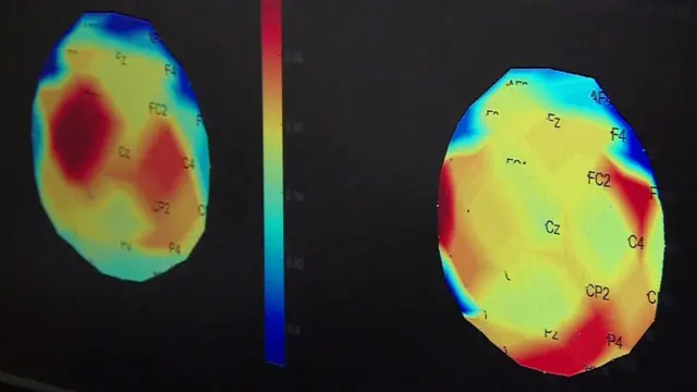 radiografias do cérebro