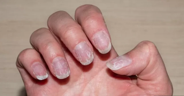 Mbọaka takachara ataka