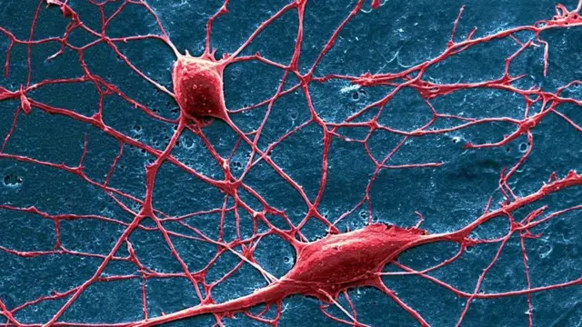 Болевые ощущения передаются нервными клетками от конечностей к спинному мозгу, а из него поступают в головной мозг