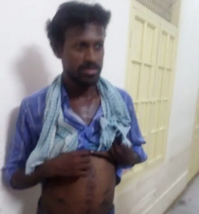 కదిరి ఆకలి చావులు