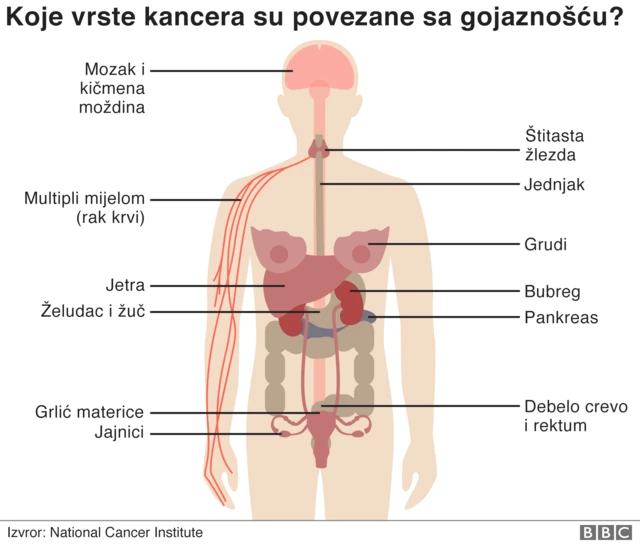 гојазност и рак