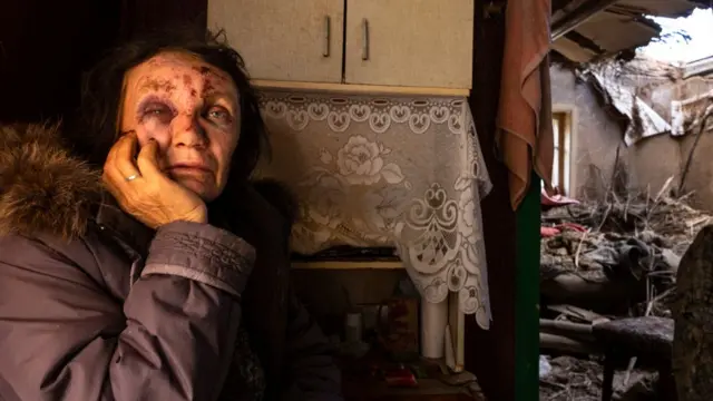 ক্রামাটোরস্কে রুশ মিসাইলের আঘাতে বিধ্বস্ত বাড়িতে বসে আছেন লেডা বুঝিনা (৫৬)। হামলায় তিনি নিজেও আহত হন।