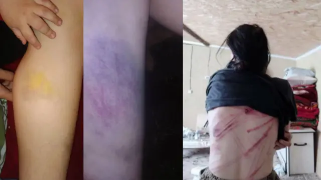 Лена дарыланууга каражаты жок экендигин айтууда 