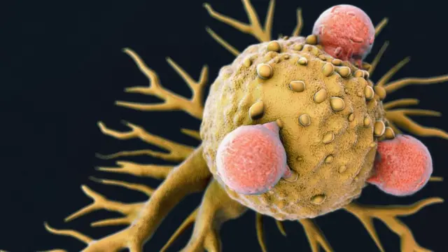 የካንሰር በሽታ