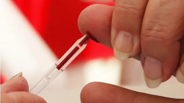 සියයට 95ක්ම අනාරක්ෂිත ලිංගික හැසිරීම් නිසා