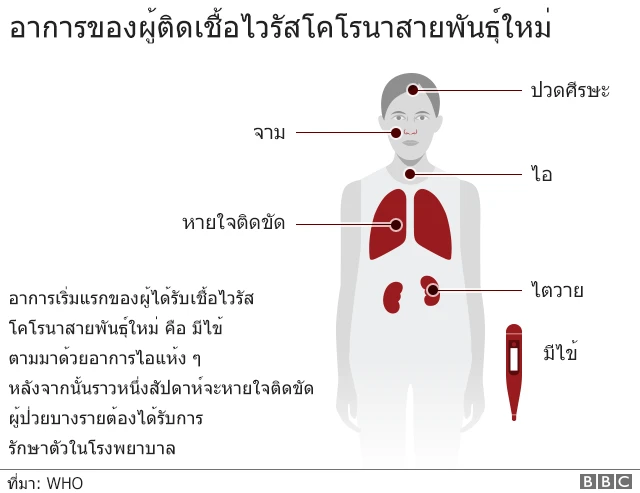 กราฟิกอาการผู้ติดเชื้อไวรัสโคโรนาสายพันธุ์ใหม่