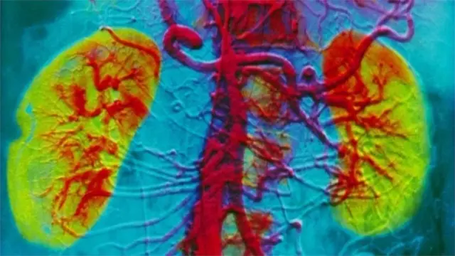 मिर्गौला