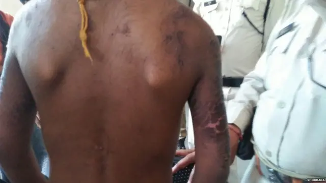 बच्चे, गोरापन, क्राइम