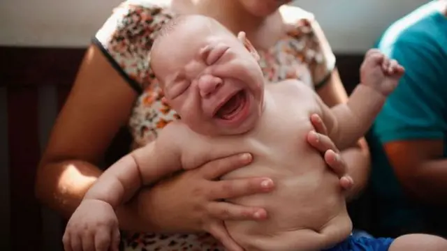 குறைபாடுகளுடன் குழந்தைகள் பிறக்க காரணமான ஜிகா வைரஸ் தொற்று