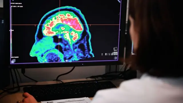 Una investigadora analiza una tomografía