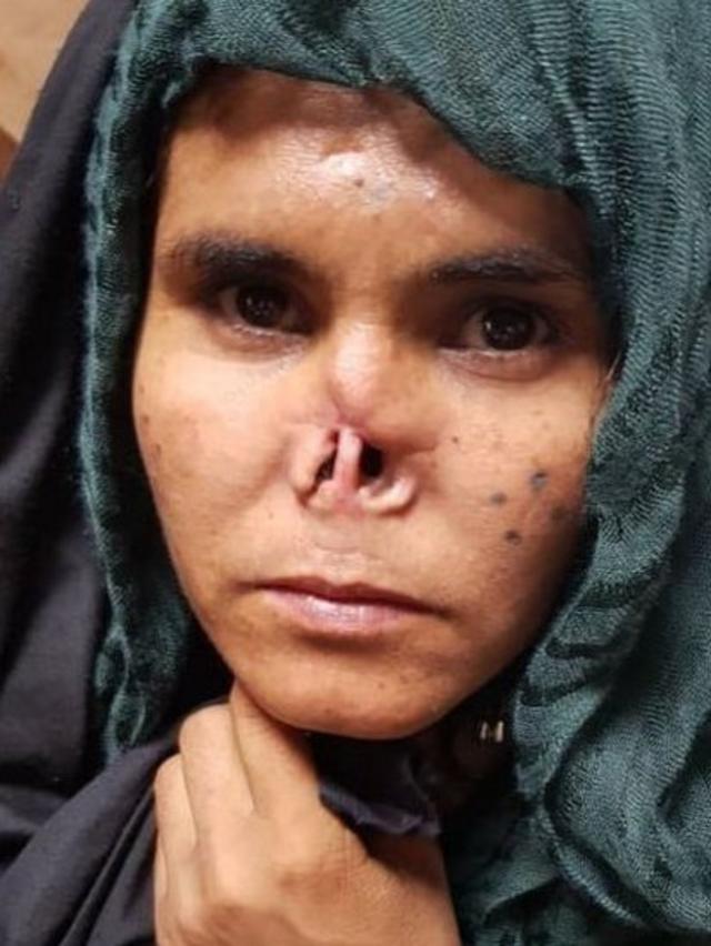 Фотографию истерзанной афганской девушки без носа и ушей признали лучшим фото || биржевые-записки.рф