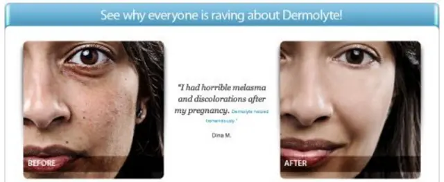 칸의 얼굴은 화장품 광고를 위한 추천문에 가짜 이름과 가짜 신분으로 쓰이기도 했다