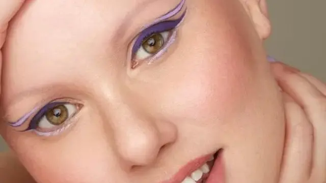 Regarder des personnes visiblement différentes ou défigurées peut leur nuire, selon Laura Mathias.