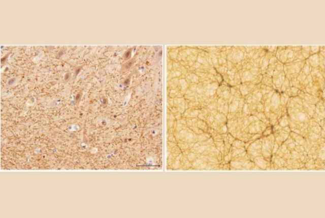 ภาพขยาย 40 เท่าของเนื้อสมองส่วนซีรีเบลลัม (ซ้าย) กับโครงข่ายเส้นใยจักรวาลในห้วงอวกาศที่กว้างด้านละ 300 ปีแสง