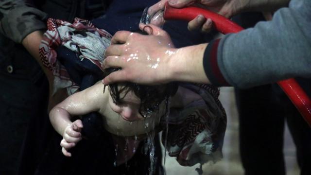 在杜马镇，一名儿童在医院的水龙头下冲刷皮肤上的化学物