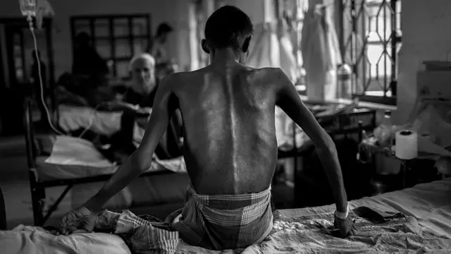 দরিদ্রতা ও অপুষ্টি,