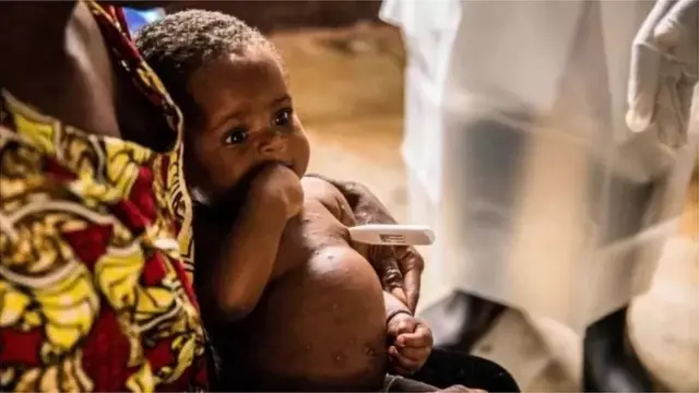 পশ্চিম ও মধ্য আফ্রিকা এবং রেইনফরেস্টে পাওয়া যায় মাংকিপক্স ভাইরাস।