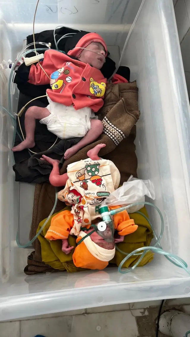 இரட்டைக் குழந்தைகள் குறைப்பிரசவத்தில் பிறந்தன; அவை மூச்சுவிடச் சிரமப்பட்டுக்கொண்டிருந்தன.
