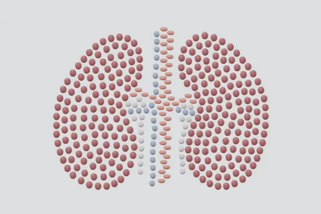 El síndrome de Eisenmenger