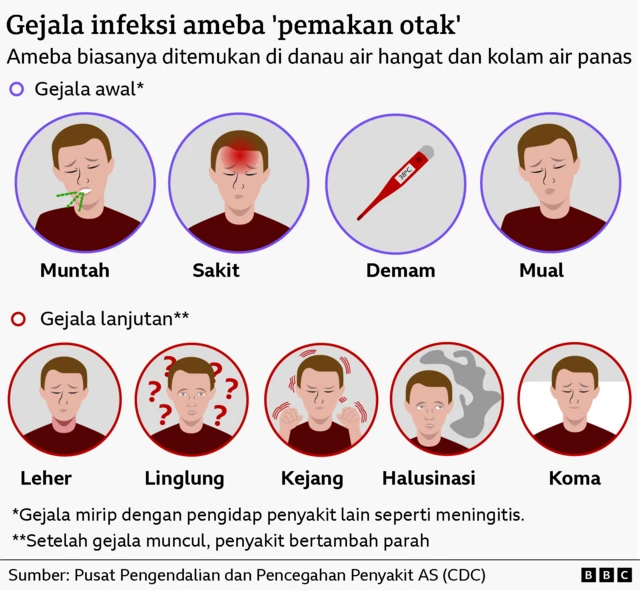 Gejala penyakit ameba Naegleria fowleri